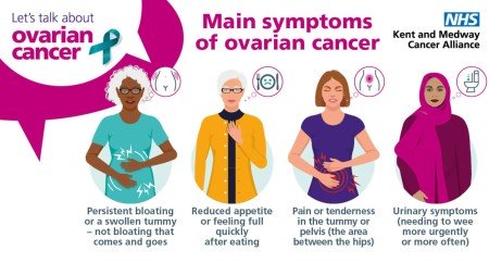 Ovarian 1